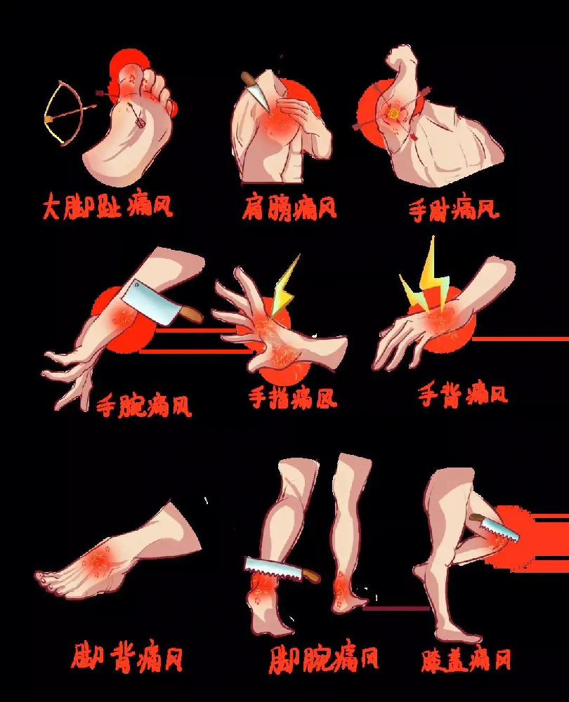 重庆痛风急诊看什么科